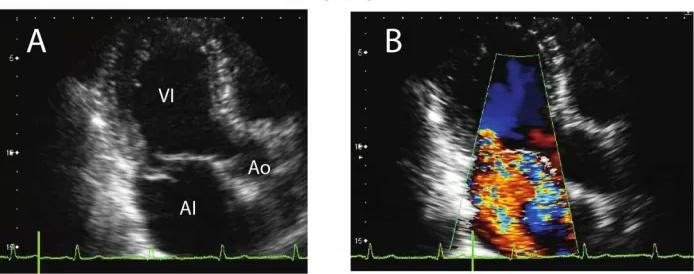 Imagen clínica de la pregunta de Cardiología