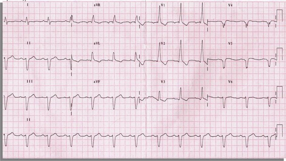 Imagen clínica de la pregunta de Cardiología