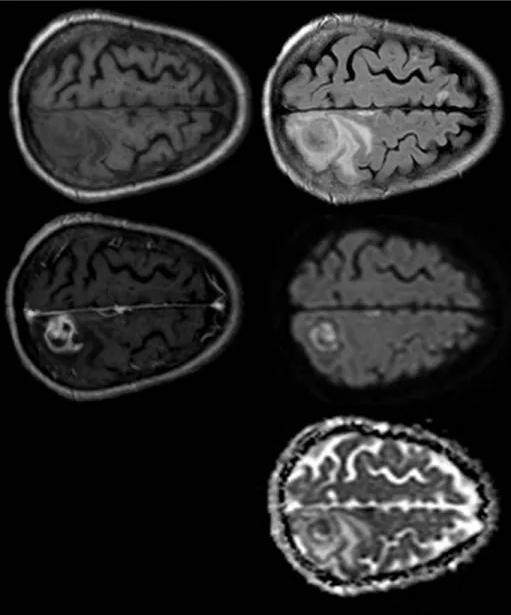 Imagen clínica de la pregunta de Neurología