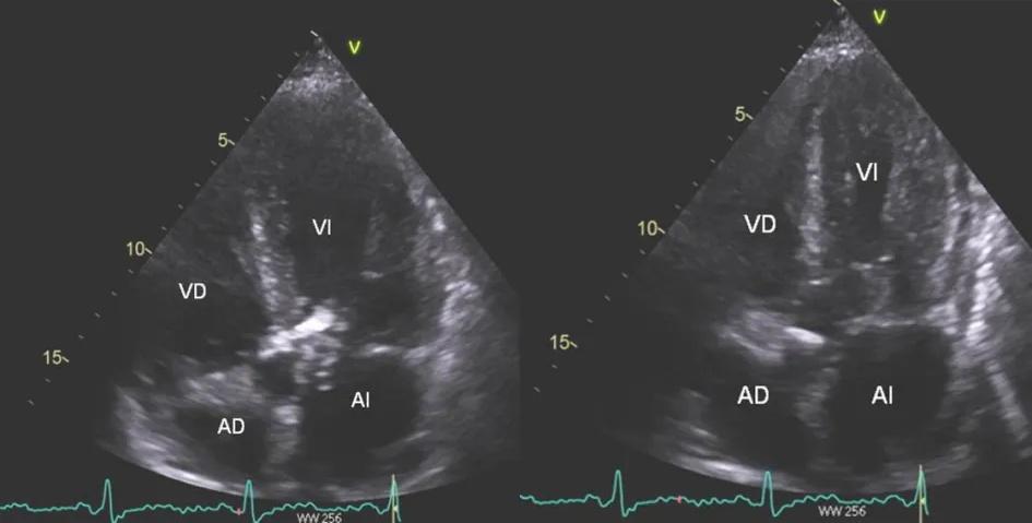 Imagen clínica de la pregunta de Cardiología