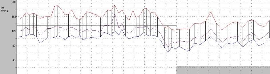 Imagen clínica de la pregunta de Cardiología