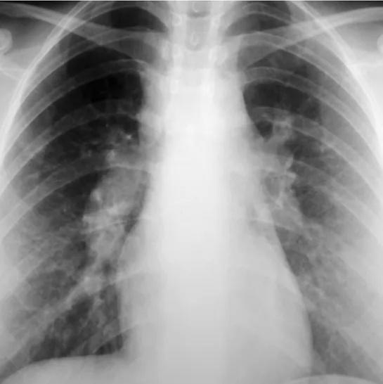 Imagen clínica de la pregunta de Respiratorio