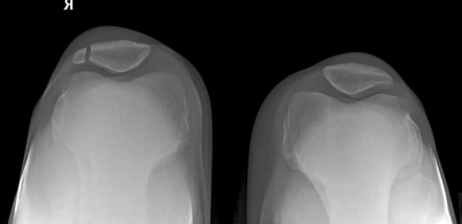 Imagen clínica de la pregunta de Traumatología