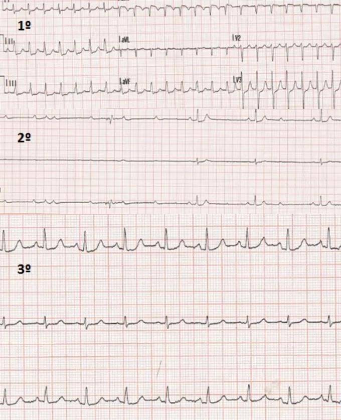 Imagen clínica de la pregunta de Cardiología