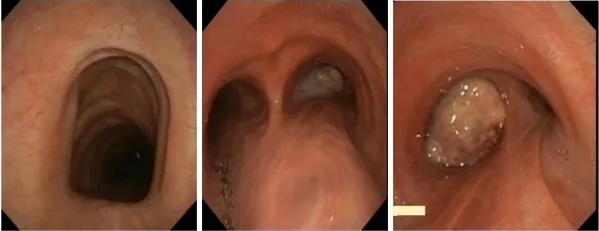 Imagen clínica de la pregunta de Respiratorio