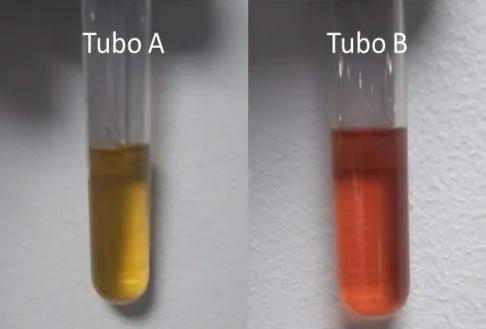 Imagen clínica de la pregunta de Hematología