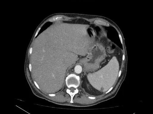 Imagen clínica de la pregunta de Cardiología