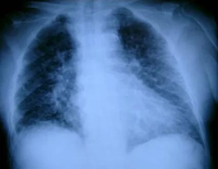 Imagen clínica de la pregunta de Cardiología