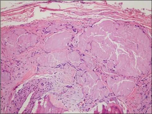 Imagen clínica de la pregunta de Hematología