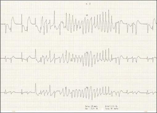 Imagen clínica de la pregunta de Cardiología