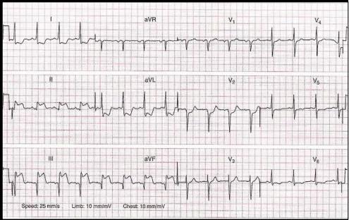 Imagen clínica de la pregunta de Cardiología