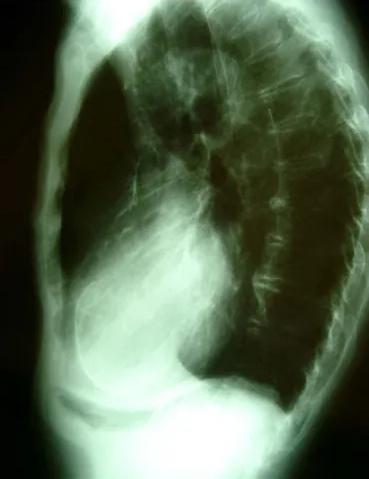 Imagen clínica de la pregunta de Cardiología