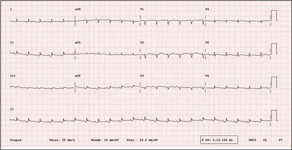 Imagen clínica de la pregunta de Cardiología