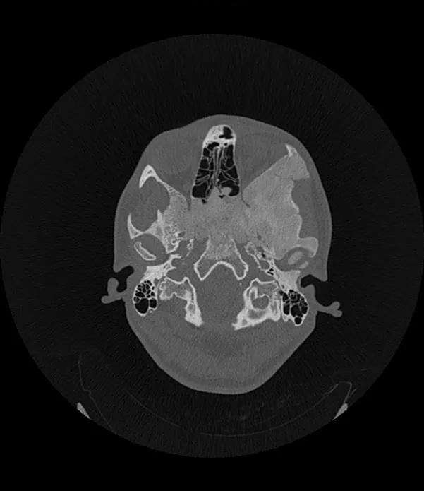 Imagen clínica de la pregunta de Oncología