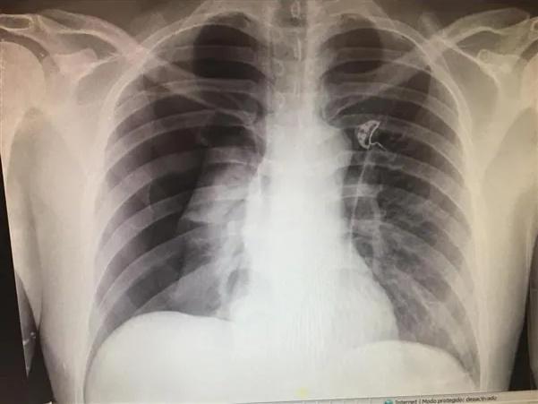 Imagen clínica de la pregunta de Urgencias