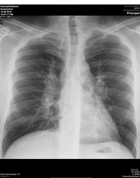 Imagen clínica de la pregunta de Respiratorio