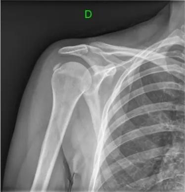 Imagen clínica de la pregunta de Traumatología