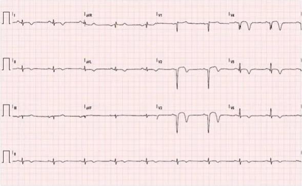 Imagen clínica de la pregunta de Cardiología
