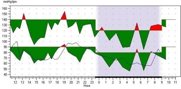 Imagen clínica de la pregunta de Cardiología