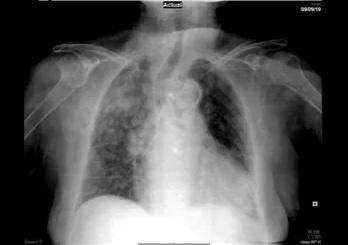 Imagen clínica de la pregunta de Respiratorio