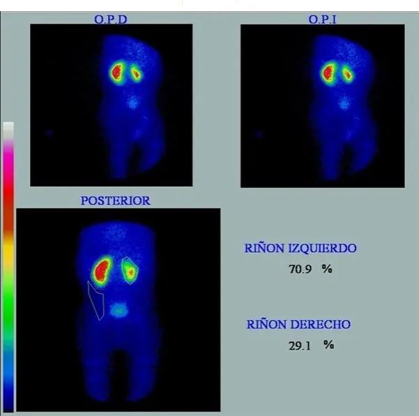 Imagen clínica de la pregunta de Pediatría