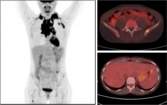 Imagen clínica de la pregunta de Hematología