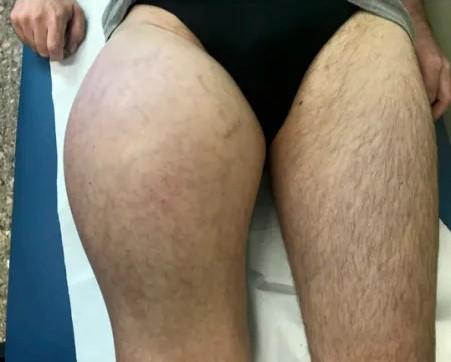 Imagen clínica de la pregunta de Oncología