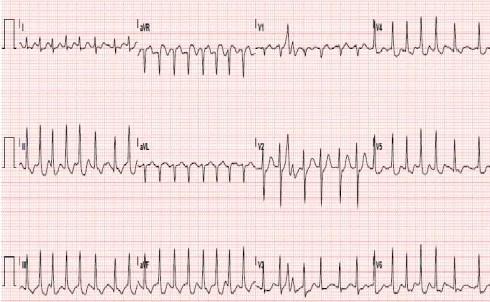 Imagen clínica de la pregunta de Cardiología