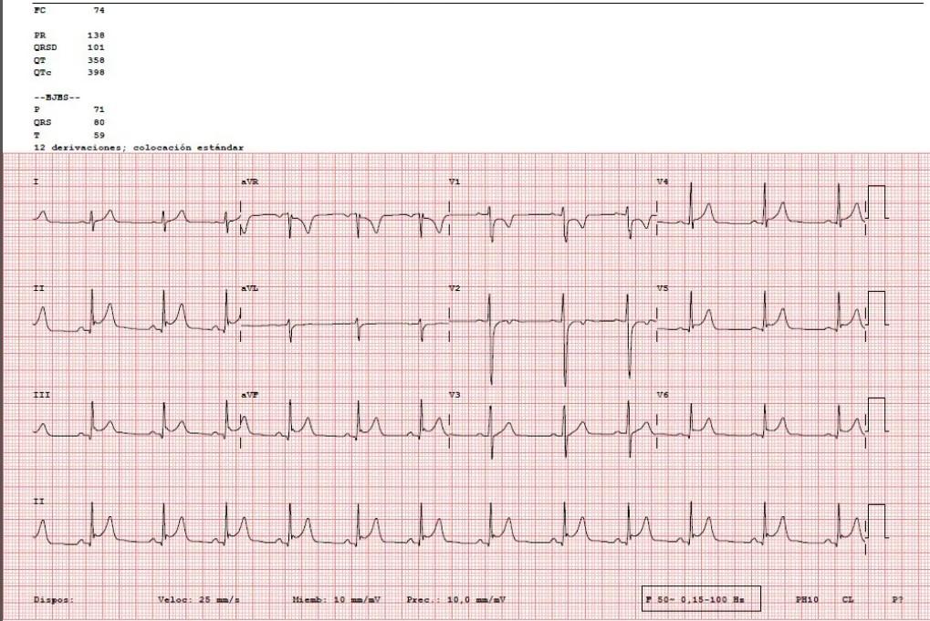Imagen clínica de la pregunta de Cardiología