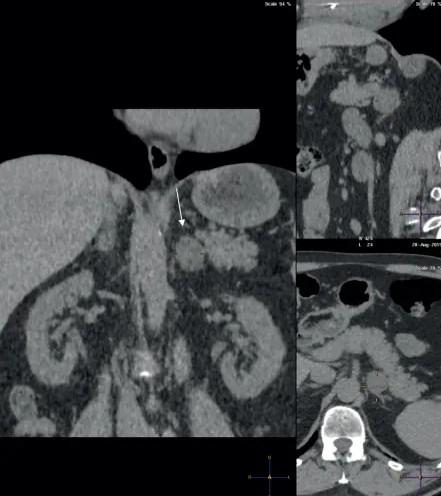 Imagen clínica de la pregunta de Endocrinología